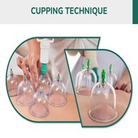 Technique 1